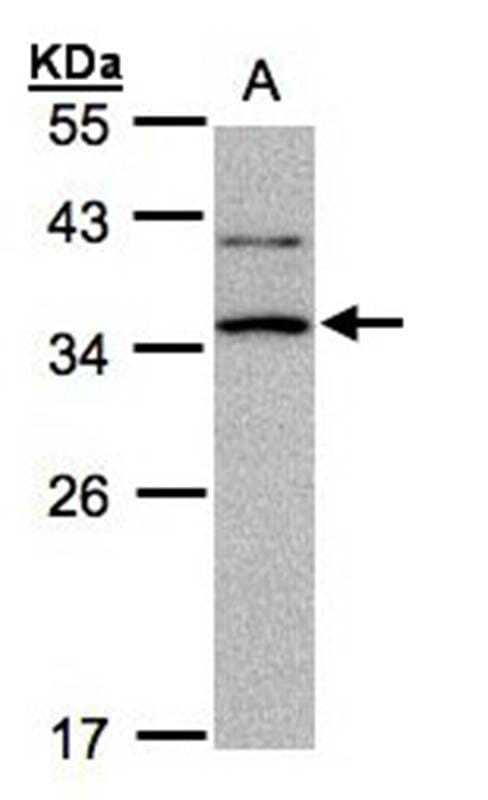 Sample 30ug of Raji whole cell lysate 12% SDS PAGE Primary antibody diluted at 1: 1000