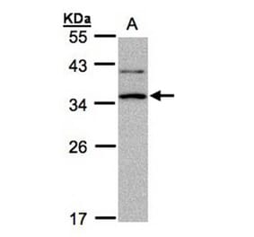 XRCC2 antibody from Signalway Antibody (22906) - Antibodies.com