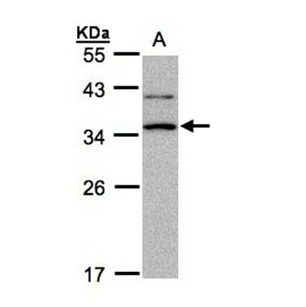 XRCC2 antibody from Signalway Antibody (22906) - Antibodies.com