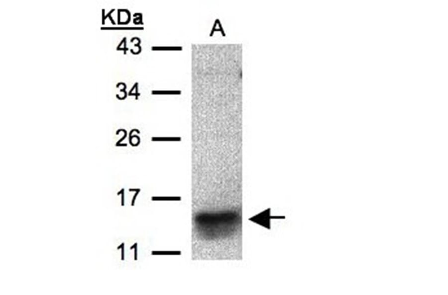 I-309 antibody from Signalway Antibody (22910) - Antibodies.com
