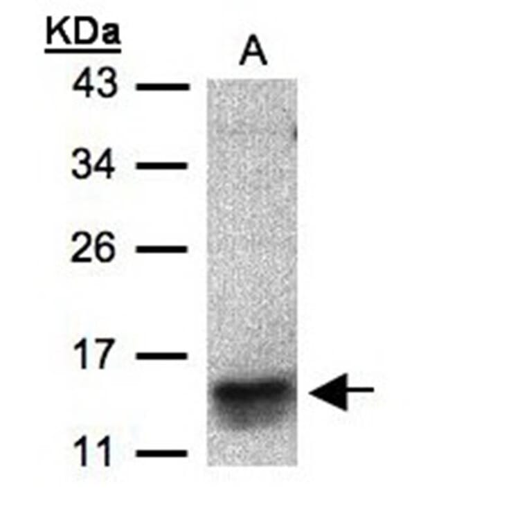 I-309 antibody from Signalway Antibody (22910) - Antibodies.com