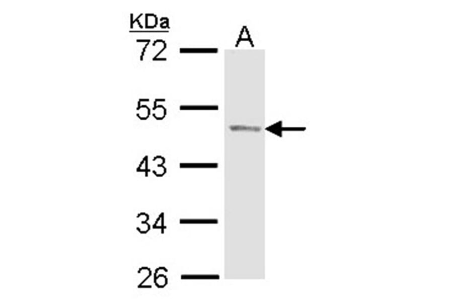 PAcP antibody from Signalway Antibody (22925) - Antibodies.com