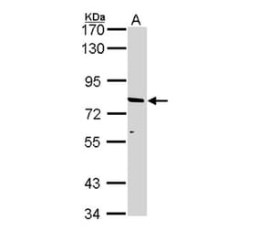 ABCD2 antibody from Signalway Antibody (22963) - Antibodies.com