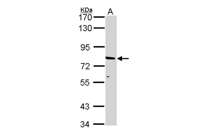 ABCD2 antibody from Signalway Antibody (22963) - Antibodies.com