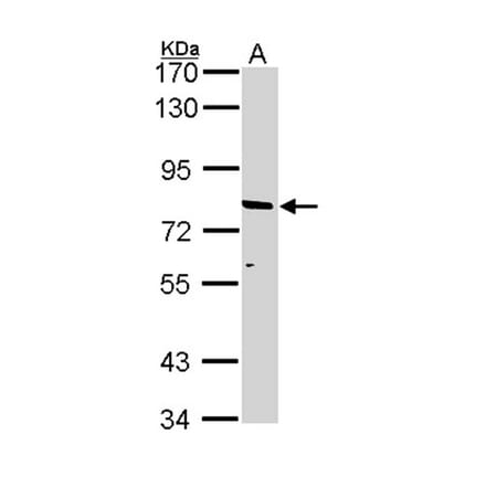 ABCD2 antibody from Signalway Antibody (22963) - Antibodies.com