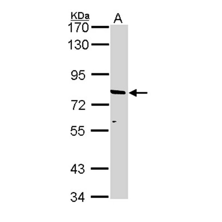 ABCD2 antibody from Signalway Antibody (22963) - Antibodies.com