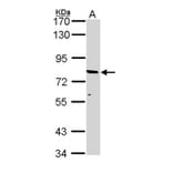 ABCD2 antibody from Signalway Antibody (22963) - Antibodies.com