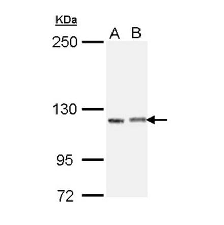 IGSF3 antibody from Signalway Antibody (23023) - Antibodies.com