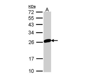 MAD2 antibody from Signalway Antibody (23039) - Antibodies.com