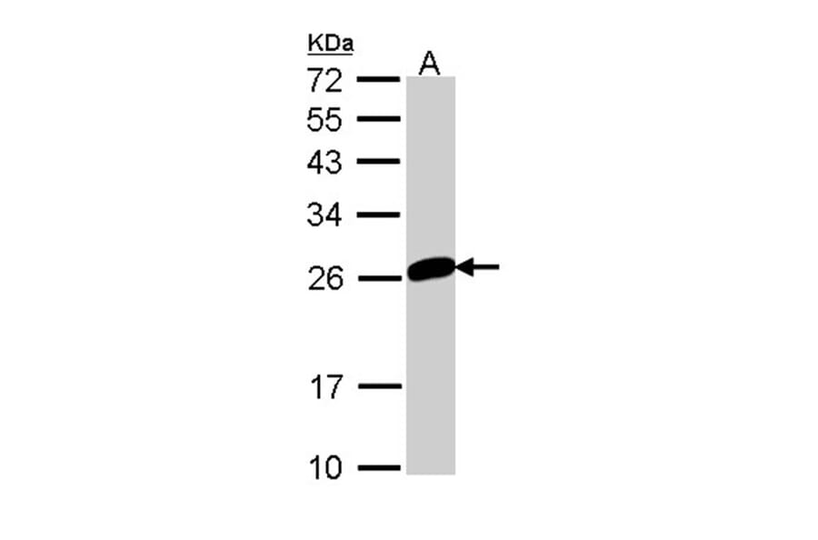 MAD2 antibody from Signalway Antibody (23039) - Antibodies.com