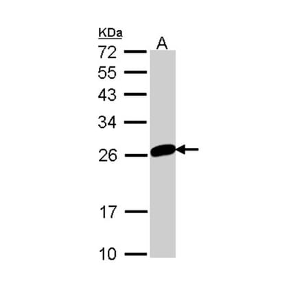 MAD2 antibody from Signalway Antibody (23039) - Antibodies.com