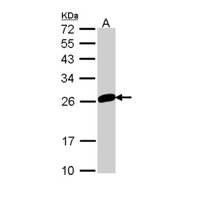 MAD2 antibody from Signalway Antibody (23039) - Antibodies.com
