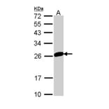 MAD2 antibody from Signalway Antibody (23039) - Antibodies.com