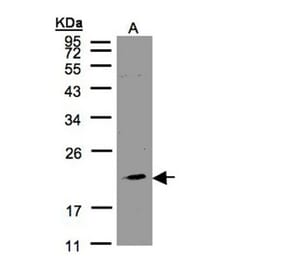 KLRC4 antibody from Signalway Antibody (23083) - Antibodies.com