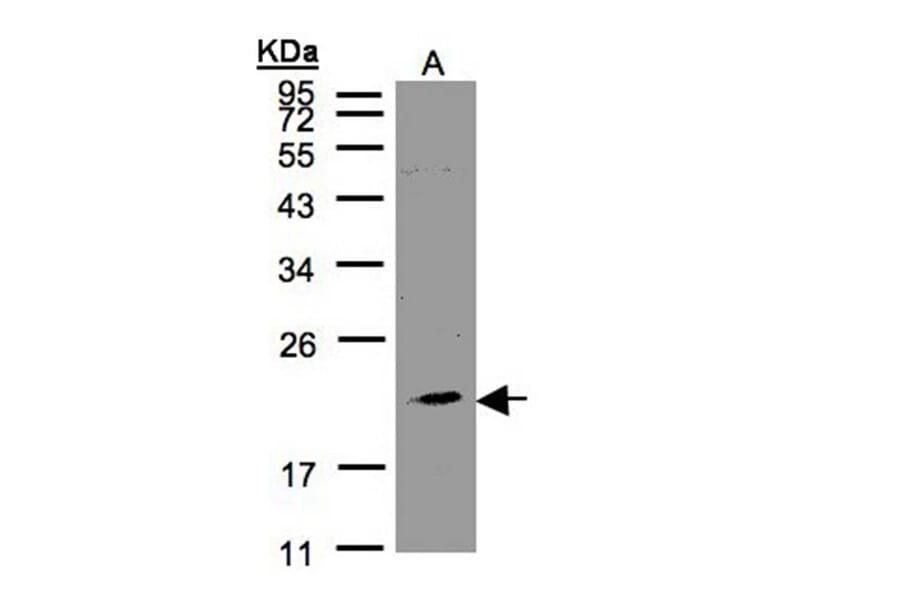 KLRC4 antibody from Signalway Antibody (23083) - Antibodies.com