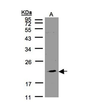 KLRC4 antibody from Signalway Antibody (23083) - Antibodies.com