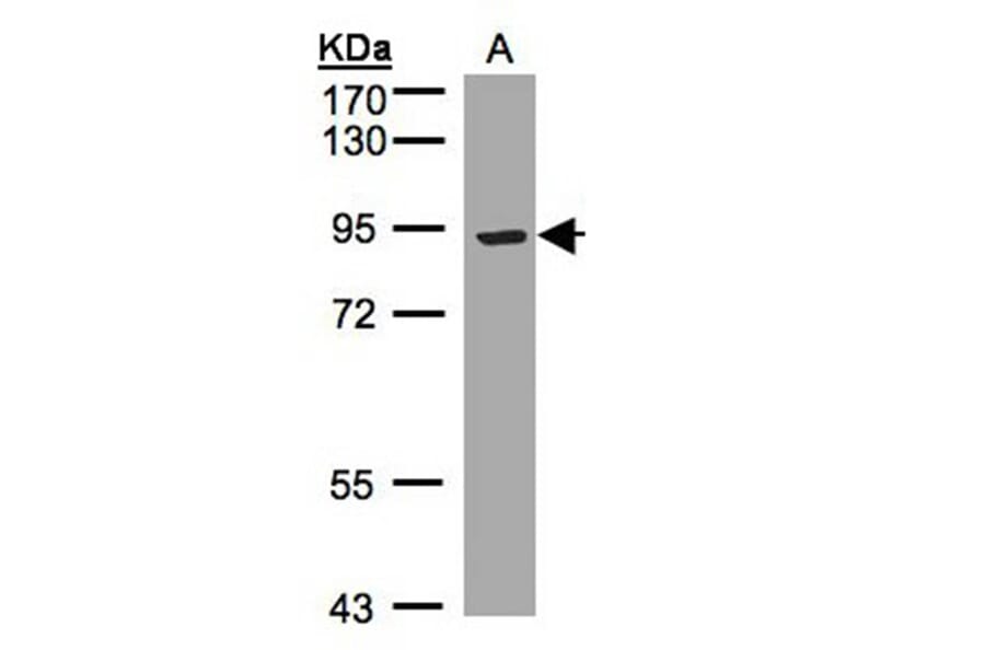 LRP12 antibody from Signalway Antibody (23126) - Antibodies.com