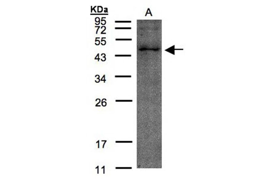 TMLHE antibody from Signalway Antibody (23139) - Antibodies.com