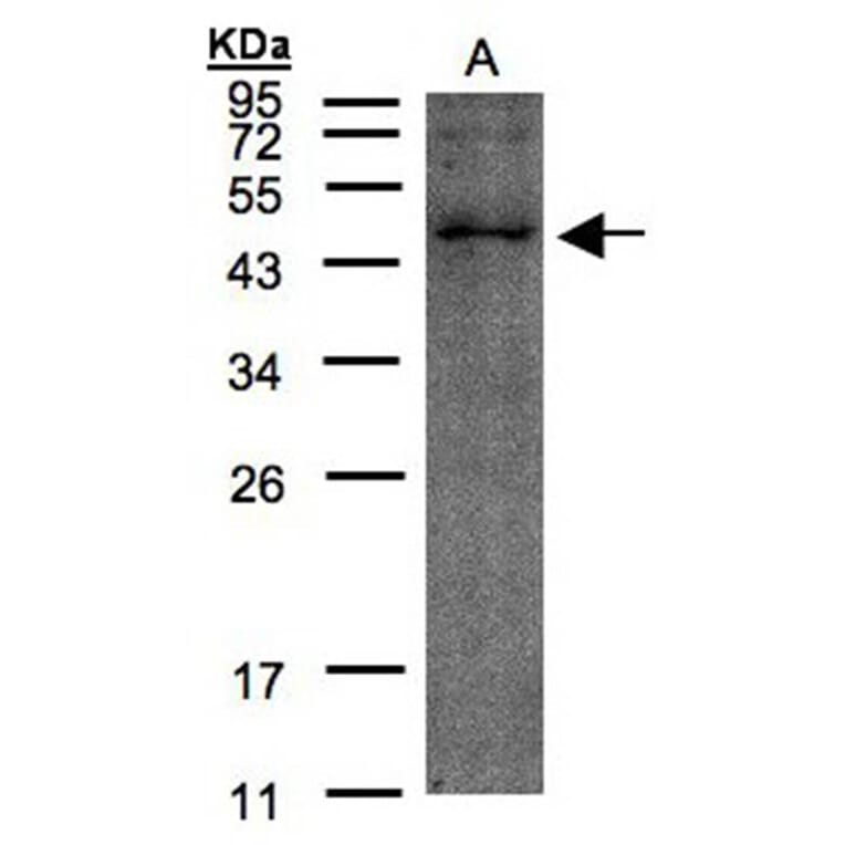TMLHE antibody from Signalway Antibody (23139) - Antibodies.com