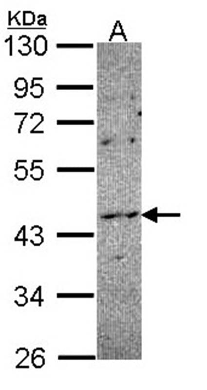 Sample (30 µg of whole cell lysate)  HCT11610% SDS PAGE Primary antibody diluted at 1: 1000