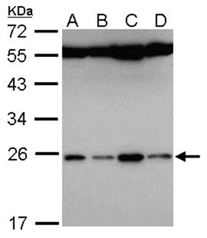 Sample (30 µg of whole cell lysate)  Hela B: Hep G2 C: Molt-4 D: Raji 12% SDS PAGE Primary antibody diluted at 1: 5000