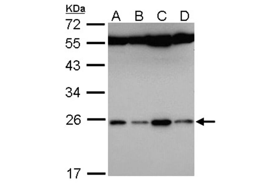 FAM9B antibody from Signalway Antibody (23175) - Antibodies.com