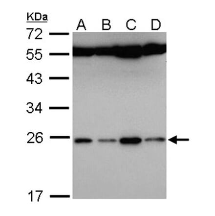 FAM9B antibody from Signalway Antibody (23175) - Antibodies.com