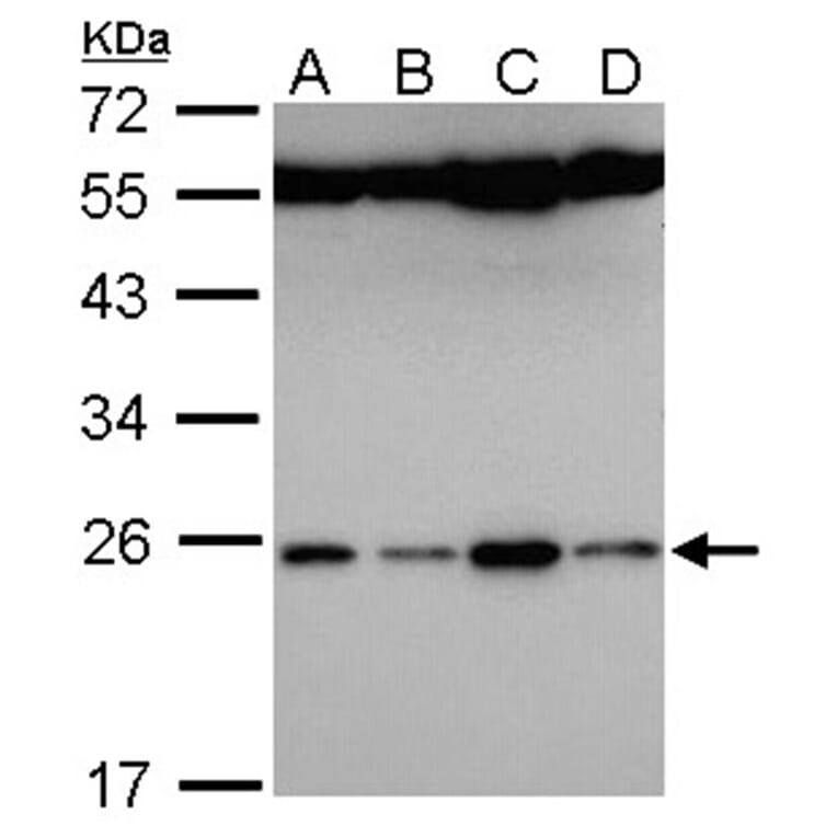 FAM9B antibody from Signalway Antibody (23175) - Antibodies.com