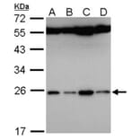 FAM9B antibody from Signalway Antibody (23175) - Antibodies.com