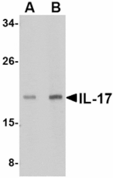 Western blot - IL-17 Antibody from Signalway Antibody (24784) - Antibodies.com
