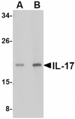 Western blot - IL-17 Antibody from Signalway Antibody (24784) - Antibodies.com