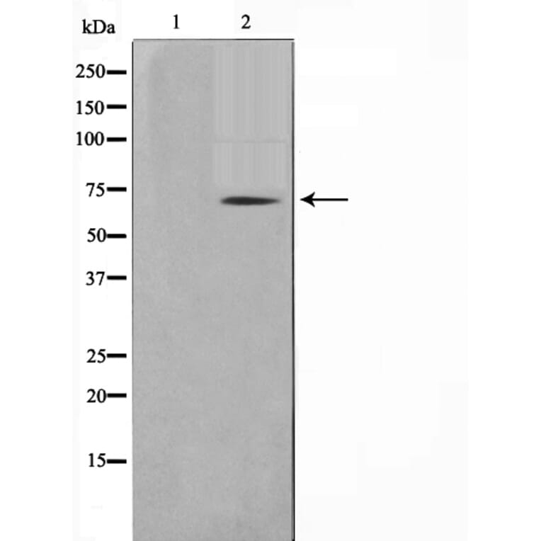 Western blot - TGFR2 Antibody from Signalway Antibody (29306) - Antibodies.com