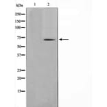 Western blot - TGFR2 Antibody from Signalway Antibody (29306) - Antibodies.com