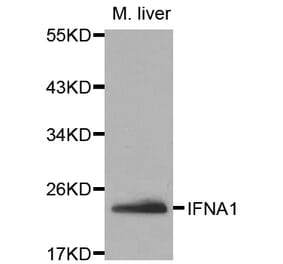 Western blot - IFNA1 Antibody from Signalway Antibody (32063) - Antibodies.com