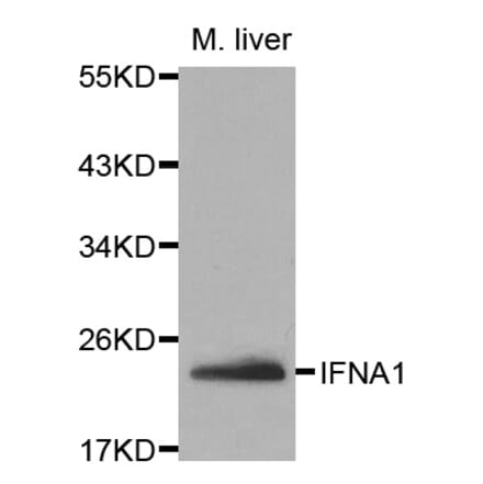 Western blot - IFNA1 Antibody from Signalway Antibody (32063) - Antibodies.com