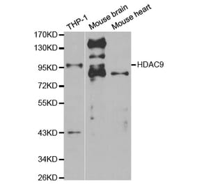 Western blot - HDAC9 Antibody from Signalway Antibody (32293) - Antibodies.com