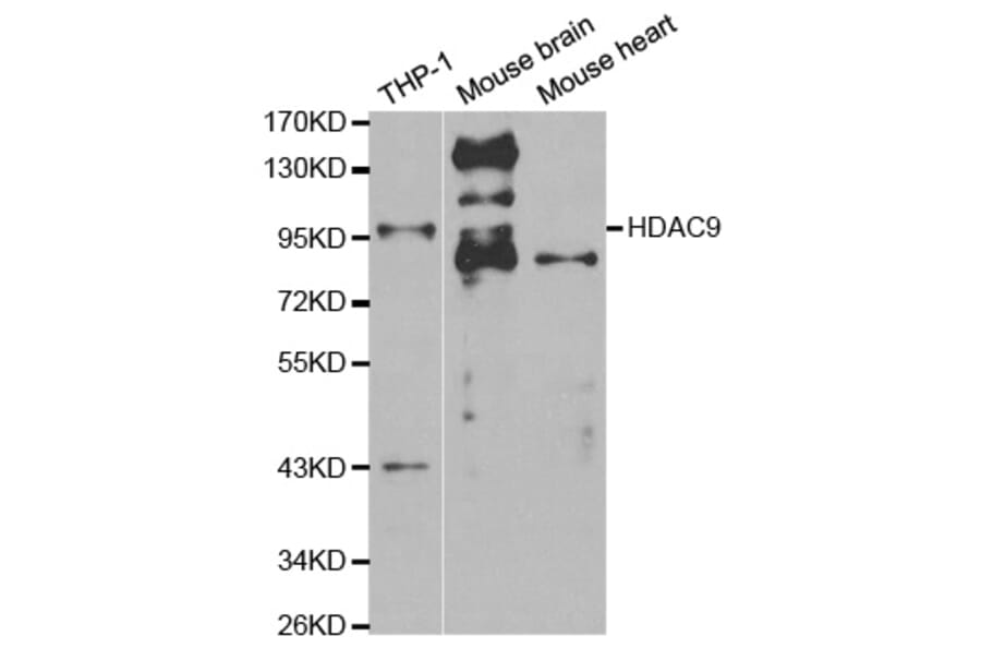Western blot - HDAC9 Antibody from Signalway Antibody (32293) - Antibodies.com