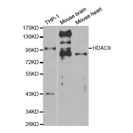 Western blot - HDAC9 Antibody from Signalway Antibody (32293) - Antibodies.com