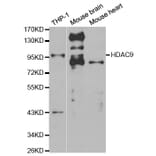 Western blot - HDAC9 Antibody from Signalway Antibody (32293) - Antibodies.com