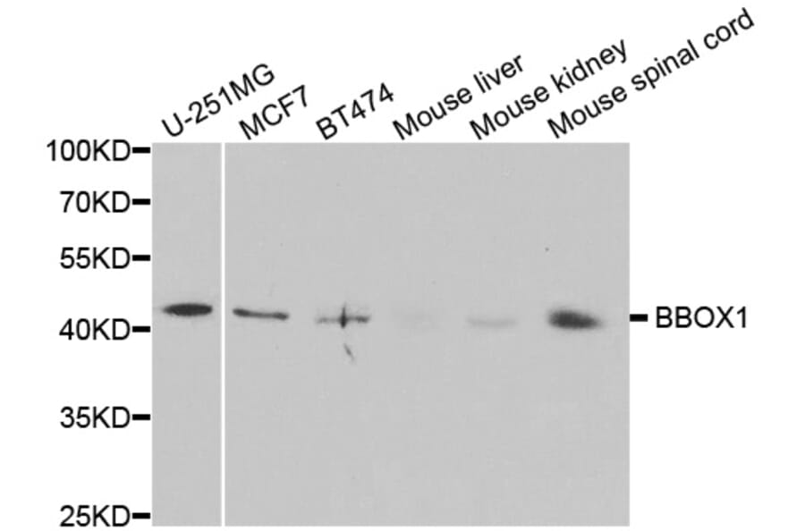 Western blot - BBOX1 Antibody from Signalway Antibody (33058) - Antibodies.com