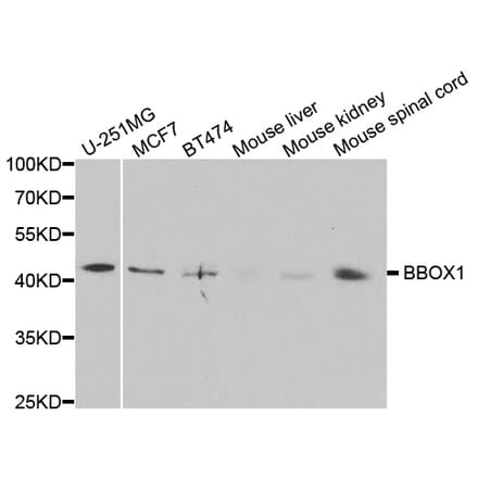 Western blot - BBOX1 Antibody from Signalway Antibody (33058) - Antibodies.com