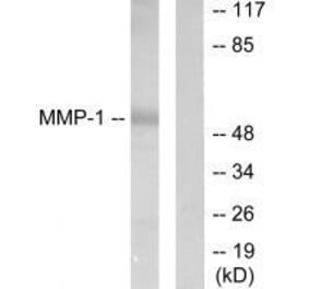 Western blot - MMP-1 Antibody from Signalway Antibody (33434) - Antibodies.com