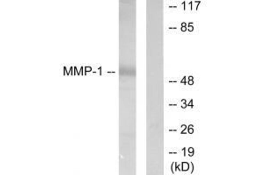 Western blot - MMP-1 Antibody from Signalway Antibody (33434) - Antibodies.com