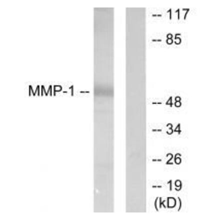Western blot - MMP-1 Antibody from Signalway Antibody (33434) - Antibodies.com