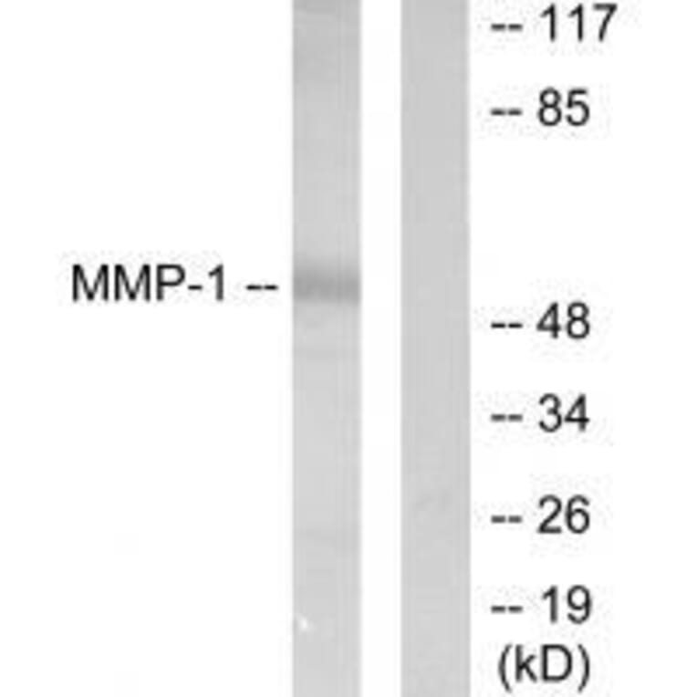 Western blot - MMP-1 Antibody from Signalway Antibody (33434) - Antibodies.com