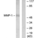 Western blot - MMP-1 Antibody from Signalway Antibody (33434) - Antibodies.com