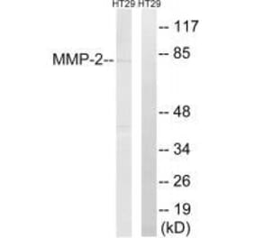 Western blot - MMP-2 Antibody from Signalway Antibody (33441) - Antibodies.com