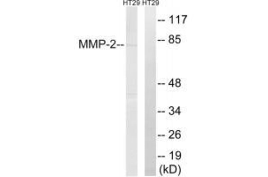 Western blot - MMP-2 Antibody from Signalway Antibody (33441) - Antibodies.com