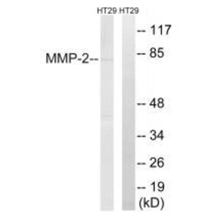 Western blot - MMP-2 Antibody from Signalway Antibody (33441) - Antibodies.com