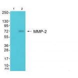 Western blot - MMP-2 Antibody from Signalway Antibody (33441) - Antibodies.com